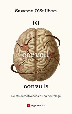 El cervell convuls | 9788417214586 | O'Sullivan, Suzanne